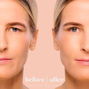 Eyelift™ strips | Een jongere uitstraling binnen 1 minuut!