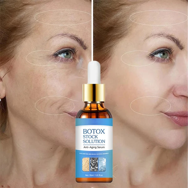 Botox in a bottle | Hét krachtigste anti-age serum – wglow